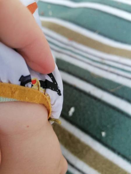 Bild zu Immer mehr rote Flecken. Was kann das sein? - Baby Forum - Allgemeine Themen