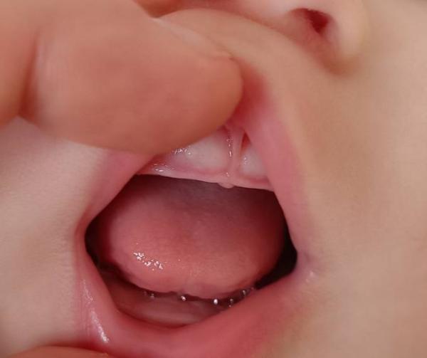 Bild zu Zahnen? - Baby Forum - Allgemeine Themen