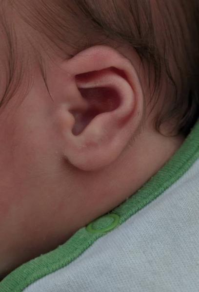 Bild zu Ohrenform: Warten oder alsbald korrigieren lassen? - Baby Forum - Allgemeine Themen