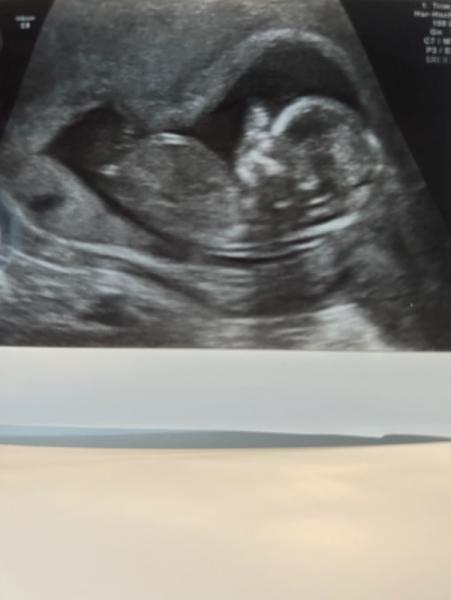 Bild zu Junge oder Mädchen. - Baby Forum - Allgemeine Themen