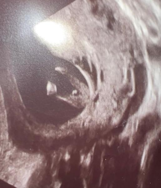 Bild zu Junge oder Mädchen?🫣🙈 - Baby Forum - Allgemeine Themen