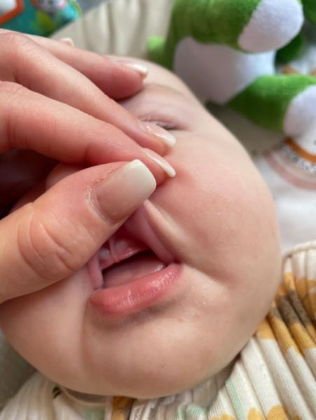 Bild zu Baby am Zahnen? - Baby Forum - Allgemeine Themen