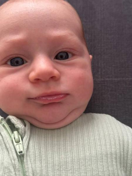 Bild zu Unterlippen weis - Baby Forum - Allgemeine Themen