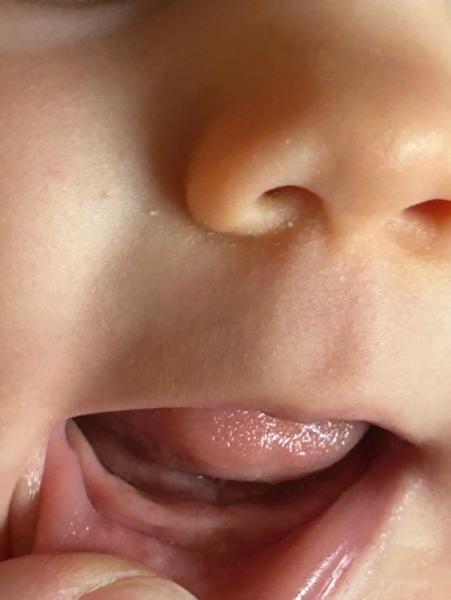 Bild zu Zahnen - Baby Forum - Allgemeine Themen