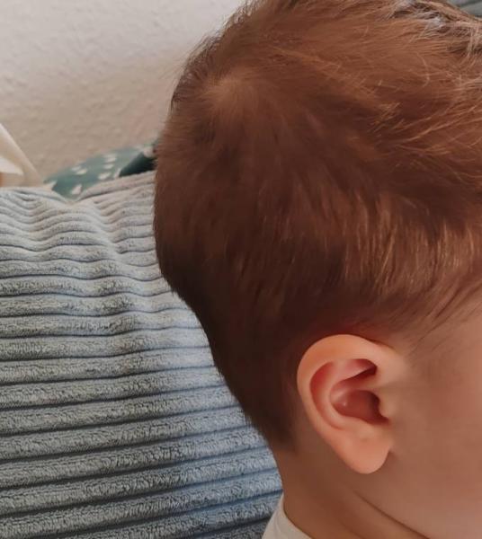 Bild zu Form Hinterkopf - Baby Forum - Allgemeine Themen