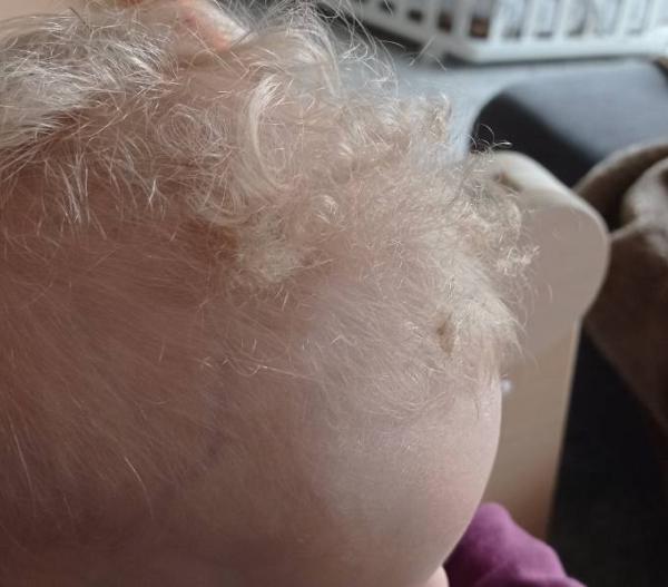 Bild zu Verfilztes Haar Baby - Baby Forum - Allgemeine Themen