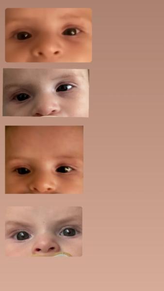 Bild zu Leichtes schielen nach innen mit dem linken auge(dreieinhalbmonatigs) - Baby Forum - Allgemeine Themen