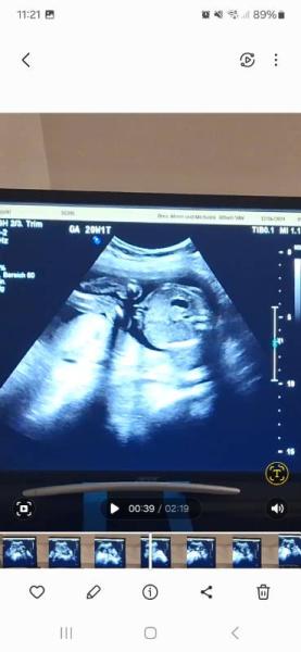 Bild zu Junge oder Mädchen? - Baby Forum - Allgemeine Themen