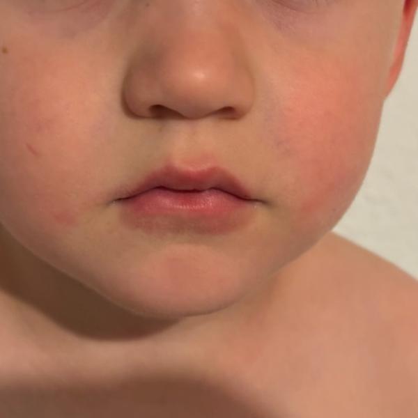 Bild zu Roter mund - Baby Forum - Allgemeine Themen