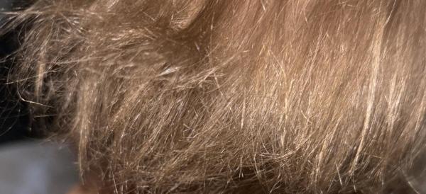 Bild zu Tipps bezüglich der Haare - Baby Forum - Allgemeine Themen