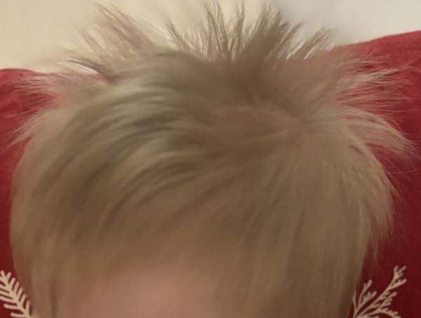 Bild zu Wuschelkopf - Baby Forum - Allgemeine Themen
