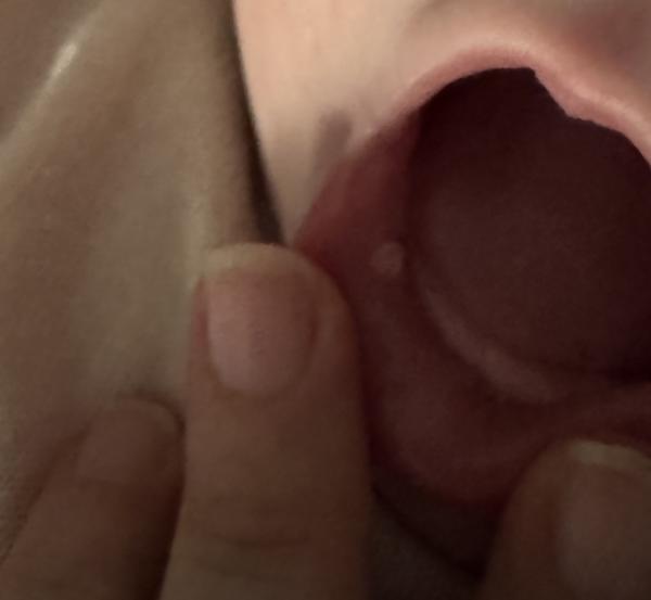 Bild zu Zipfel im Baby - Baby Forum - Allgemeine Themen