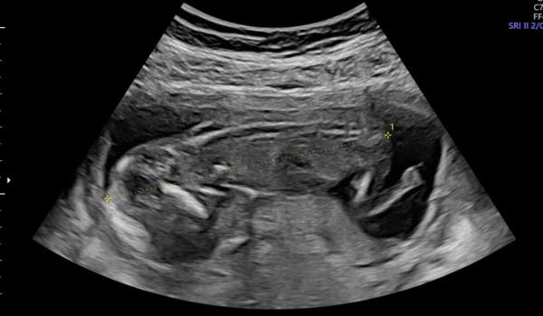 Bild zu Welches Geschlecht hat mein Baby? - Baby Forum - Allgemeine Themen