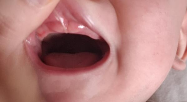 Bild zu Kommen da demnächst Zähne? - Baby Forum - Allgemeine Themen