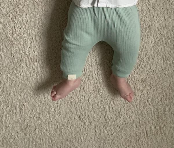 Bild zu Fußfehlstellung? - Baby Forum - Allgemeine Themen