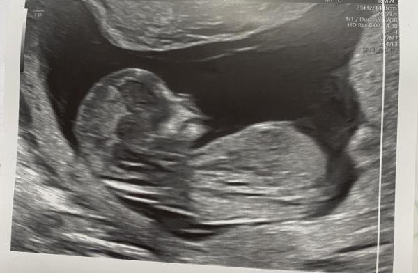 Bild zu Nub Methode, kennt sich jemand aus? - Baby Forum - Allgemeine Themen