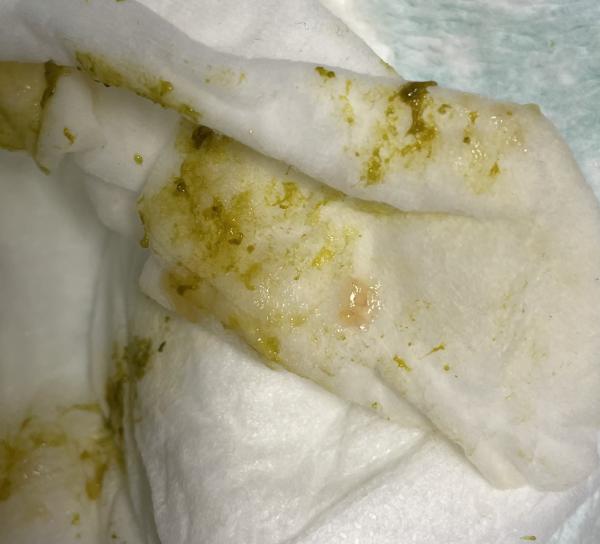 Bild zu 5 Monate altes Baby, komischer Stuhlgang - Baby Forum - Allgemeine Themen