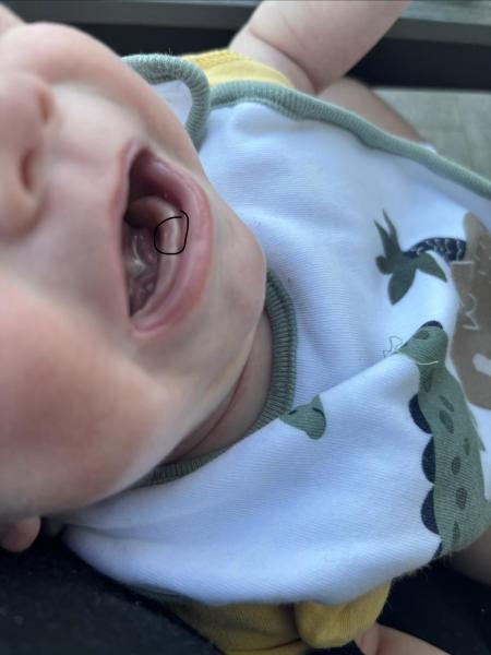 Bild zu Schon ein Zahn? - Baby Forum - Allgemeine Themen