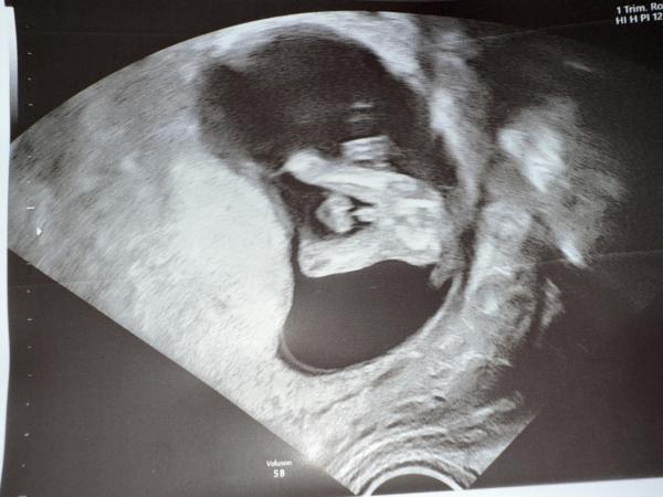 Bild zu Seht ihr einen Jungen oder ein Mädchen? :-)) - Baby Forum - Allgemeine Themen