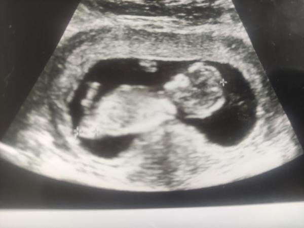 Bild zu Ich hätte eine Frage zur Nub Theorie - Baby Forum - Allgemeine Themen