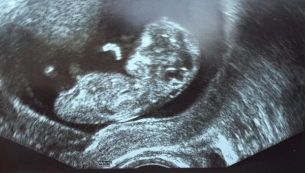 Bild zu Mädchen oder Junge ? :) - Baby Forum - Allgemeine Themen