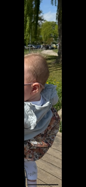 Bild zu Abgeflachter Hinterkopf. - Expertenforum ✔️Babyosteopathie