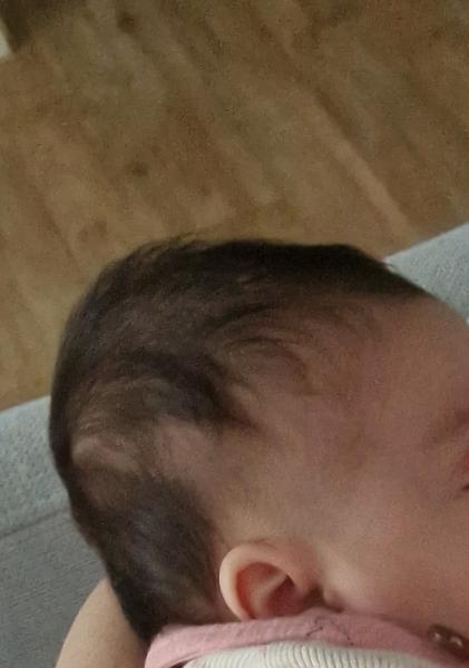 Bild zu Abgeflachter Hinterkopf - Expertenforum ✔️Babyosteopathie