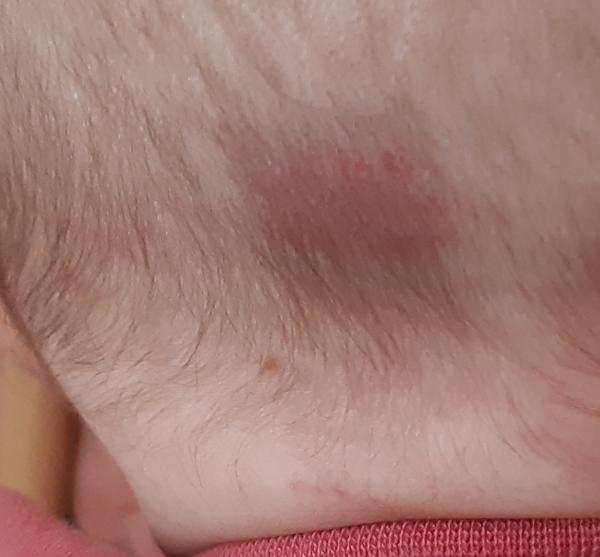 Bild zu Hinterkopf - Haut von Babys und Kindern ✔️ Expertenforum