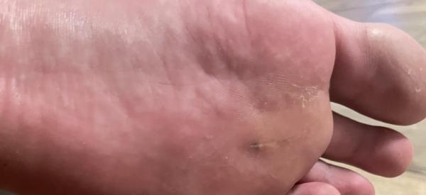Bild zu zusätzliches Foto - Haut von Babys und Kindern ✔️ Expertenforum