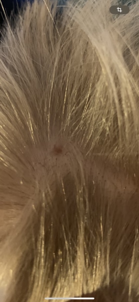 Bild zu Nochmal Fleck an Kopf - Haut von Babys und Kindern ✔️ Expertenforum