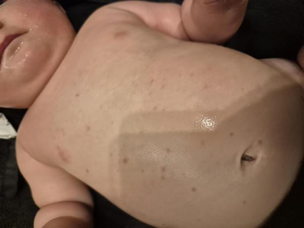 Bild zu Rote Punkte bei Baby 7 Monate - Haut von Babys und Kindern ✔️ Expertenforum