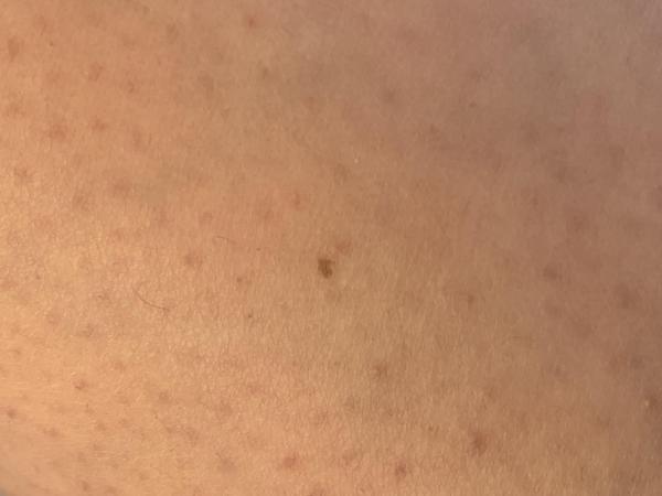 Bild zu Mutterma - Haut von Babys und Kindern ✔️ Expertenforum