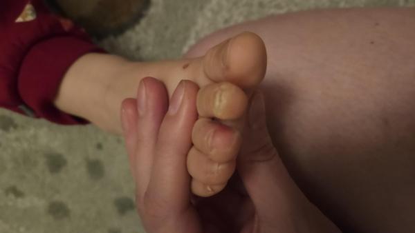 Bild zu Haut löst sich an Zehen - Haut von Babys und Kindern ✔️ Expertenforum