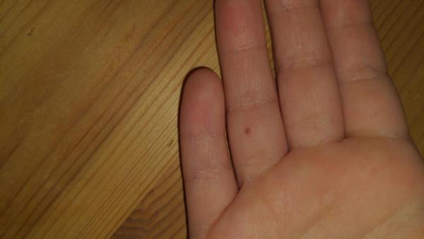 Bild zu Mutter mal auf Handinnenfläche - Haut von Babys und Kindern ✔️ Expertenforum