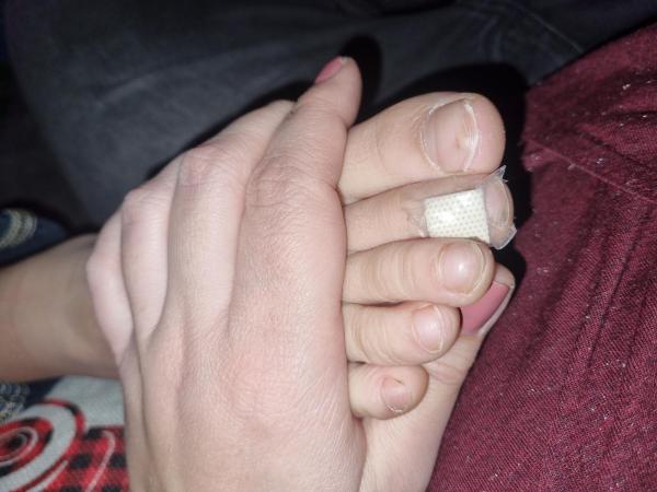 Bild zu Dornwarze? Form der Nägel - Haut von Babys und Kindern ✔️ Expertenforum