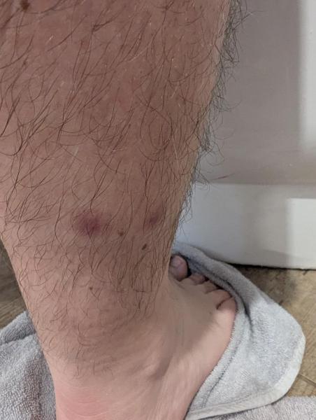 Bild zu Hautausschlag - Haut von Babys und Kindern ✔️ Expertenforum