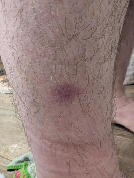 Bild zu Hautausschlag - Haut von Babys und Kindern ✔️ Expertenforum