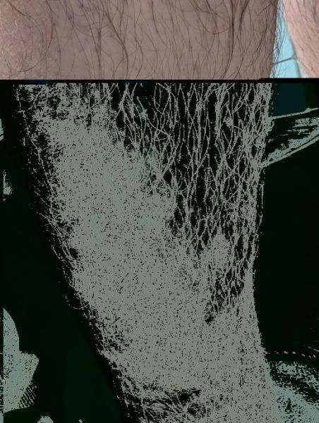 Bild zu Hautausschlag - Haut von Babys und Kindern ✔️ Expertenforum