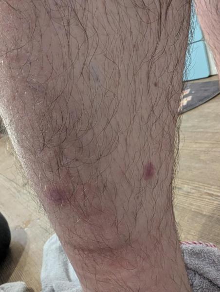 Bild zu Hautausschlag - Haut von Babys und Kindern ✔️ Expertenforum