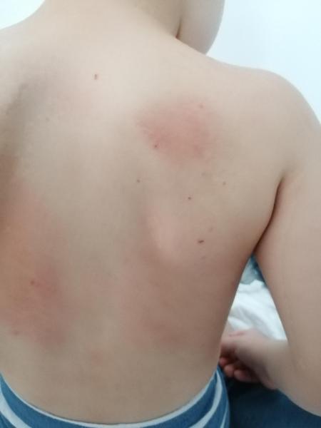 Bild zu Hautausschlag - Haut von Babys und Kindern ✔️ Expertenforum