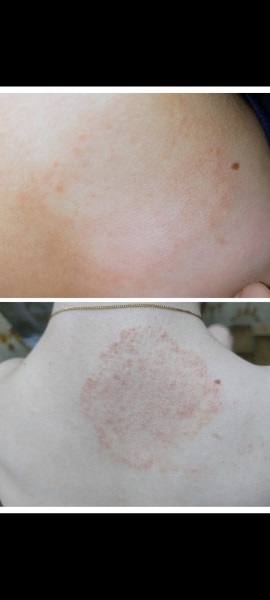 Bild zu Wie oft weiter Cremen - Haut von Babys und Kindern ✔️ Expertenforum