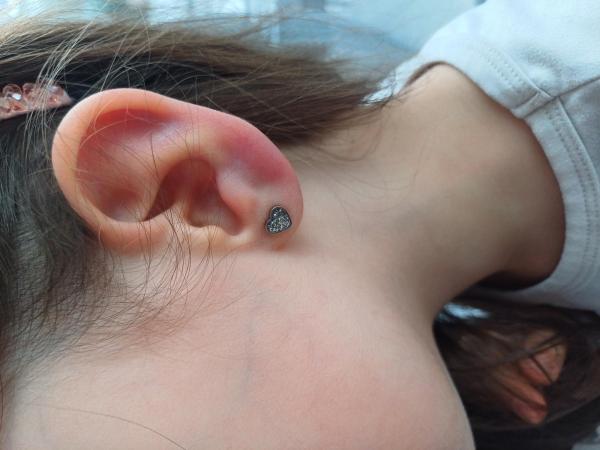 Bild zu Rotes,schmerzendes Ohrläppchen - Haut von Babys und Kindern ✔️ Expertenforum