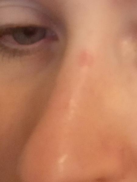 Bild zu Nachtrag Bild zu vorherigen Frage - Haut von Babys und Kindern ✔️ Expertenforum