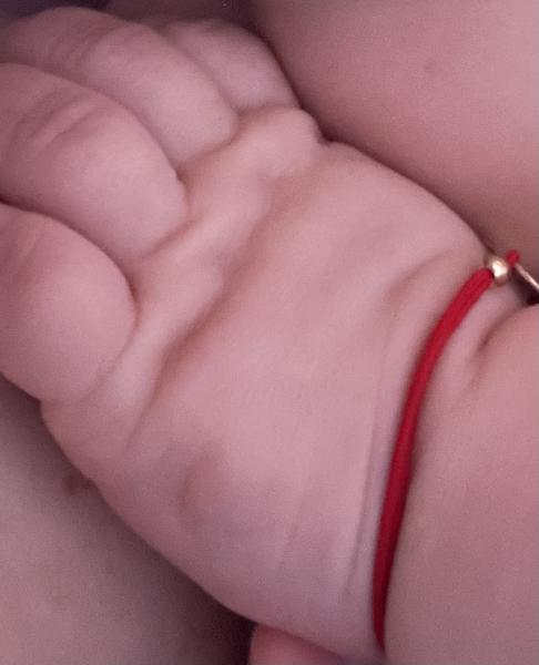 Bild zu 5 Monate altes Baby Blase auf einer Vernarbung und Rötung am Bauch und Rücken - Haut von Babys und Kindern ✔️ Expertenforum