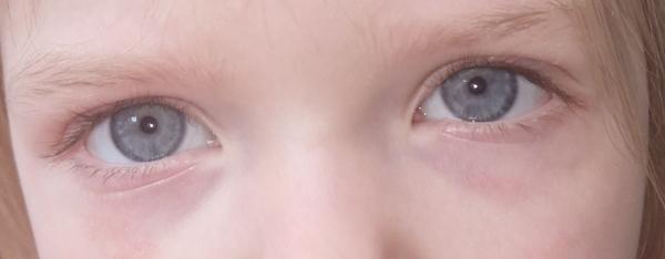 Bild zu Frage - Haut von Babys und Kindern ✔️ Expertenforum