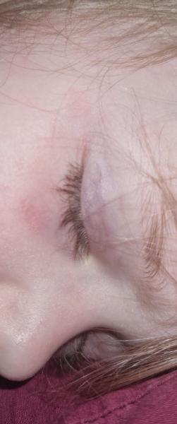 Bild zu Frage - Haut von Babys und Kindern ✔️ Expertenforum