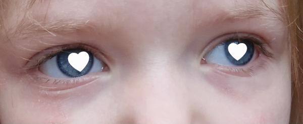 Bild zu Augenringe - Haut von Babys und Kindern ✔️ Expertenforum