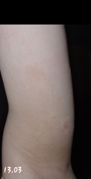 Bild zu Frage - Haut von Babys und Kindern ✔️ Expertenforum