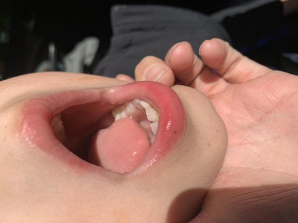 Bild zu Nachtrag - Haut von Babys und Kindern ✔️ Expertenforum