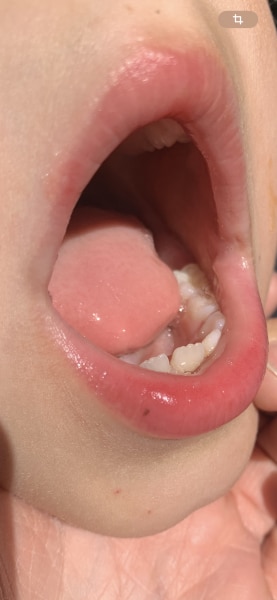 Bild zu Nachtrag - Haut von Babys und Kindern ✔️ Expertenforum